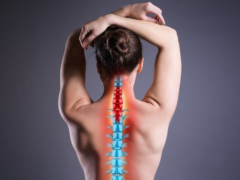 animazione di donna con ernia del disco nel collo