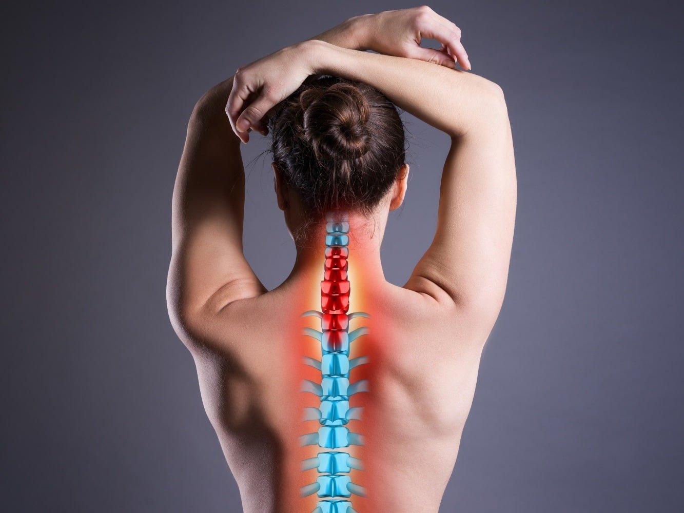 animatie van vrouw met hernia in de nek