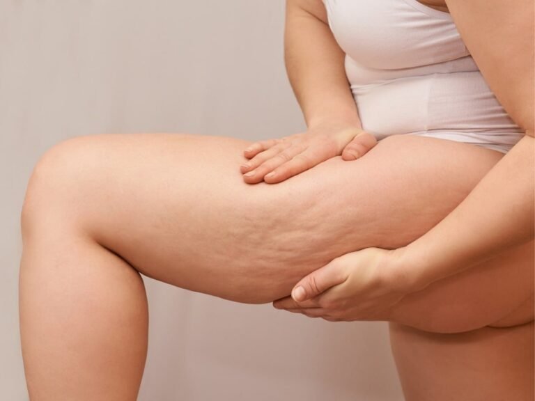 vrouw met zware benen oorzaak