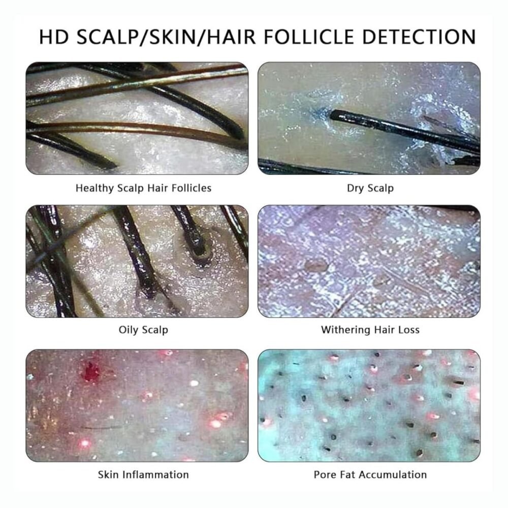 Hoofdhuid Analyse Apparaat