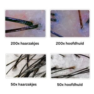 Hoofdhuid Analyse Apparaat
